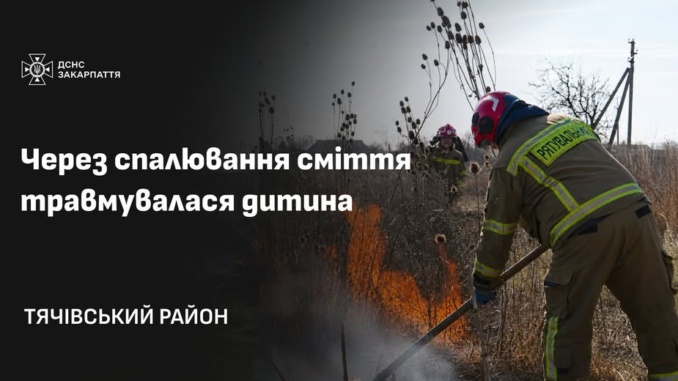 На Тячівщині дитина отримала опіки через вибух аерозольного балончика у багатті