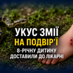 Укус змії на подвір’ї