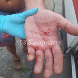 В Ужгороді домашній собака покусав двох людей