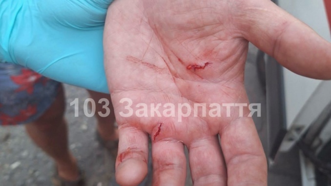 В Ужгороді домашній собака покусав двох людей